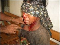 Documentary evidence 5 from Periyamadu IDP Camp Shelling